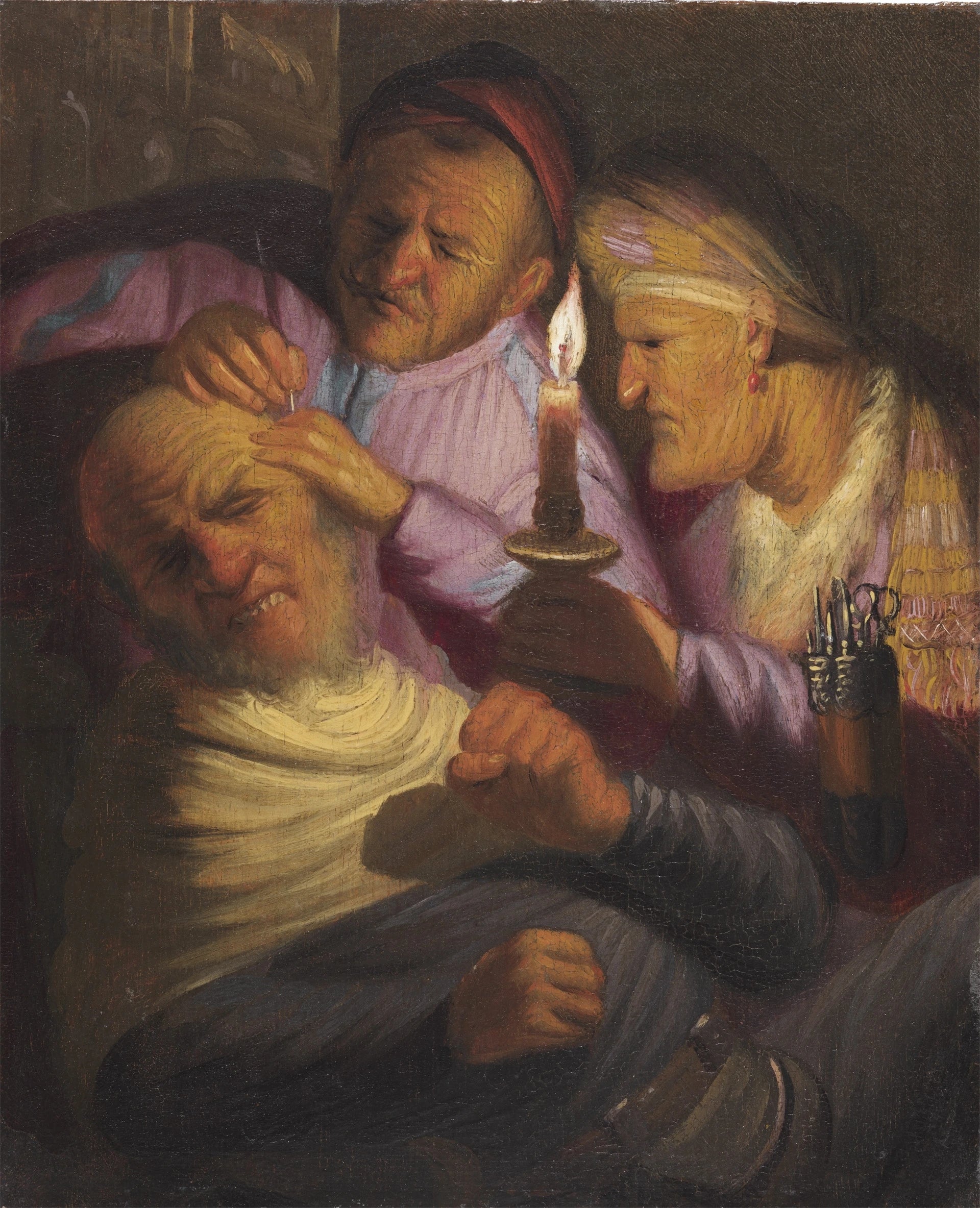 L’Opération de la pierre, allégorie du Toucher — Rembrandt